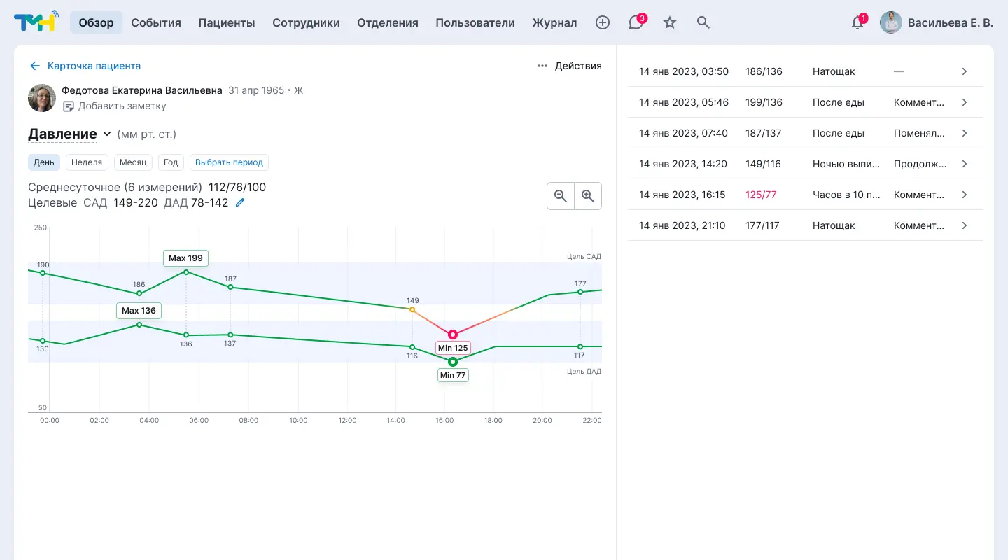 Медицинский интерфейс. График давления за день | SobakaPav.ru